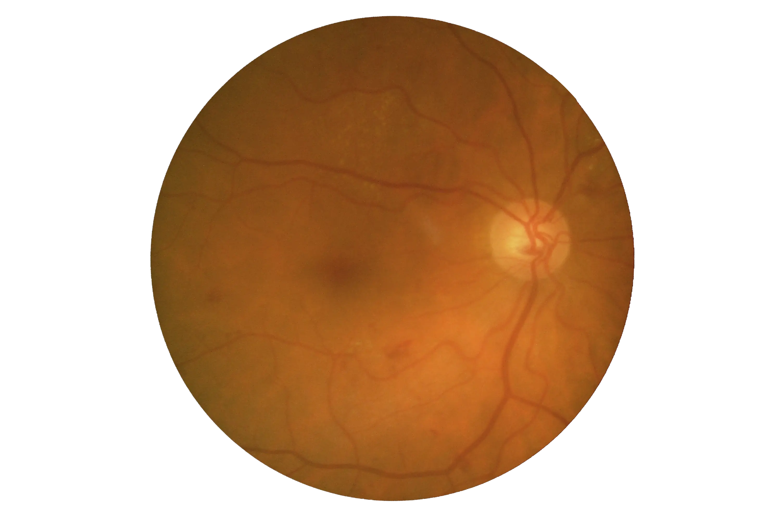 retina-img